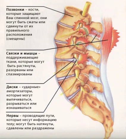 Підвивих хребця симптоми, ознаки, діагностика та лікування (лікування) Підвивих хребця симптоми, ознаки, діагностика та лікування