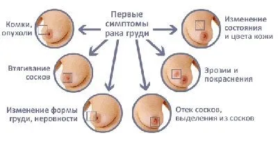 Користь і шкода зубної пасти з фтором або без фтору (зубної) Користь і шкода зубної пасти з фтором або без фтору