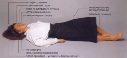 Втрата свідомості з судомами, причини таких непритомності (втрата) Втрата свідомості з судомами, причини таких непритомності
