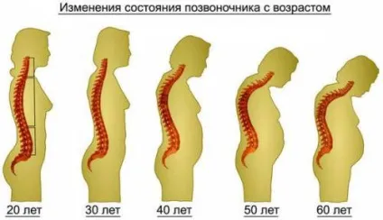 Хребетний стовп людини будова (схема), відділи хребта і функції (відділи) Хребетний стовп людини будова (схема), відділи хребта і функції