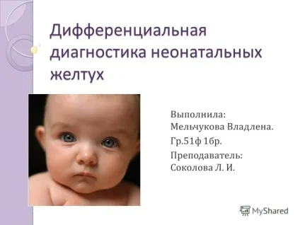 Презентація на тему диференціальна діагностика неонатальних жовтяниць виконала мельчукова владлена (діагностика) Презентація на тему диференціальна діагностика неонатальних жовтяниць виконала мельчукова владлена