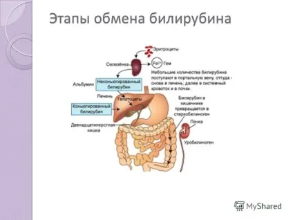 Презентація на тему диференціальна діагностика неонатальних жовтяниць виконала мельчукова владлена (диференціальна діагностика неонатальних жовтяниць виконала: мельчукова владлена. Гр.51ф 1бр. Викладач: соколова л. І.) Презентація на тему диференціальна діагностика неонатальних жовтяниць виконала мельчукова владлена