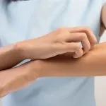 Застосування прополісу в гінекології для лікування ерозії шийки матки, циститу і запалень (лікування) Застосування прополісу в гінекології для лікування ерозії шийки матки, циститу і запалень