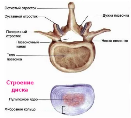 Протрузія міжхребцевих дисків, можливі наслідки хвороби (протрузія) Протрузія міжхребцевих дисків, можливі наслідки хвороби