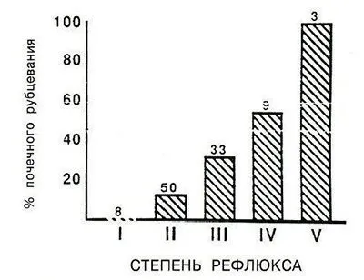 Міхурово-сечовідний рефлюкс (немовля) Міхурово-сечовідний рефлюкс