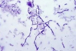 Рід бактерій bacillus cereus, subtilis, licheniformis, thuringiensis