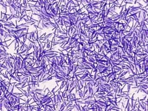Рід бактерій bacillus cereus, subtilis, licheniformis, thuringiensis