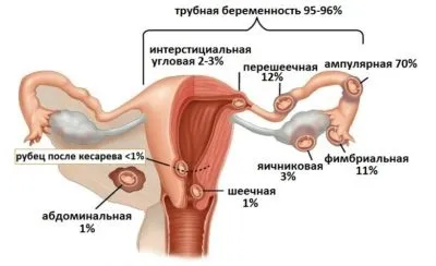 Різі в животі причини патології та лікування (животі) Різі в животі причини патології та лікування