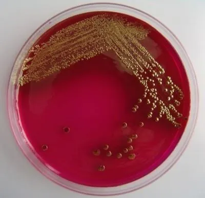 Рід бактерій bacillus cereus, subtilis, licheniformis, thuringiensis