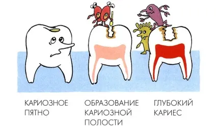 Як пояснити дитині, що є багато солодкого, цукерок итд (солодощі) Як пояснити дитині, що є багато солодкого, цукерок итд