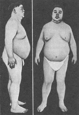 Щитовидна залоза (glandula thyroidea), ендокринні залози, анатомія людини (заліза) Щитовидна залоза (glandula thyroidea), ендокринні залози, анатомія людини