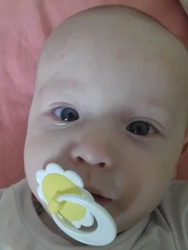 зламала голову