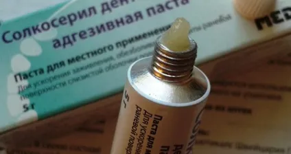 Солкосерил дентальна паста для ясен інструкція (солкосерил) Солкосерил дентальна паста для ясен інструкція