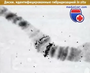 Будова політенних хромосом