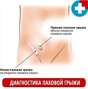 Вражена пахова грижа у дорослого (пахова) Вражена пахова грижа у дорослого