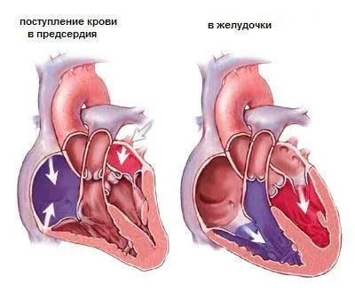 Забій серця симптоми, причини, види