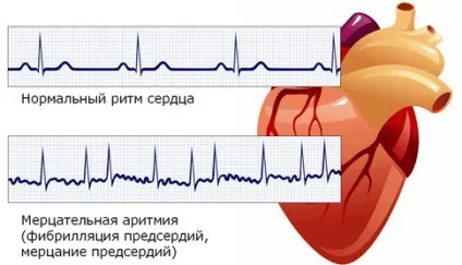 Забій серця що робити, як лікувати травму (травму) Забій серця що робити, як лікувати травму