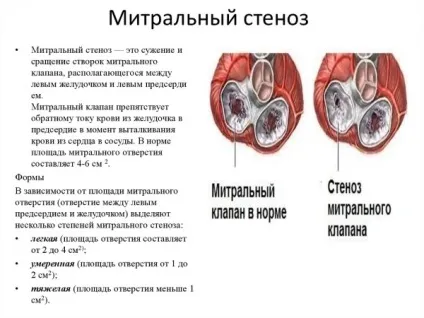 Узі серця норми і патології (патології) Узі серця норми і патології
