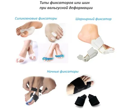 Вальгусна шина огляд бандажів і фіксаторів, відгуки (шина) Вальгусна шина огляд бандажів і фіксаторів, відгуки