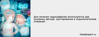 Внутрішня гідроцефалія головного мозку симптоми і лікування