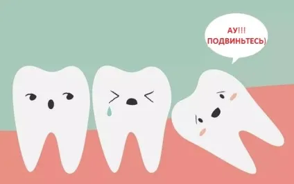Вісімки - зуби мудрості - видаляти чи ні