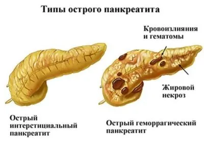 У животі різі причини патології та специфіка лікування (патології) У животі різі причини патології та специфіка лікування