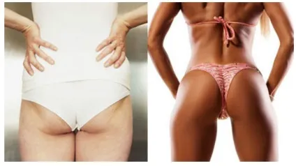 Худі товстушки і товсті худеньких або як не стати skinny fat (як не стати skinny fat) Худі товстушки і товсті худеньких або як не стати skinny fat