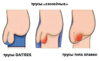 Що робити, якщо застудив яєчка - симптоми і лікування (робити) Що робити, якщо застудив яєчка - симптоми і лікування