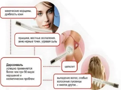 Дарсонваль для волосся, як користуватися апаратом