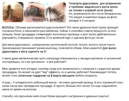 Дарсонваль для волосся (від випадіння та для росту) як користуватися, відгуки про ефективність, ціна і (дарсонваль волосся відгуки купити користуватися зростання випадання) Дарсонваль для волосся (від випадіння та для росту) як користуватися, відгуки про ефективність, ціна і