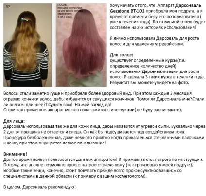 Дарсонваль для волосся (від випадіння та для росту) як користуватися, відгуки про ефективність, ціна і (зростання) Дарсонваль для волосся (від випадіння та для росту) як користуватися, відгуки про ефективність, ціна і