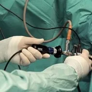 Епіцістома сечового міхура фото, механізм, догляд (сечового) Епіцістома сечового міхура фото, механізм, догляд