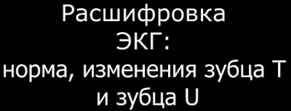 Fireaid електрокардіографія - ЕКГ ознаки ІХС інфаркту міокарда і стенокардії (інфаркт) Fireaid електрокардіографія - ЕКГ ознаки ІХС інфаркту міокарда і стенокардії