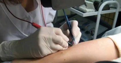 Епіляція рук 5 способів видалення волосся на руках (волосся) Епіляція рук 5 способів видалення волосся на руках