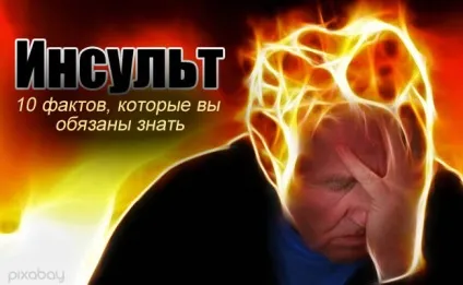 Інсульт головного мозку факти, сіптоми і поради (мозок) Інсульт головного мозку факти, сіптоми і поради