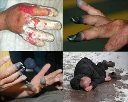 Як не замерзнути на смерть і не отримати обмороження на холоді - безпека в надзвичайних (смерть) Як не замерзнути на смерть і не отримати обмороження на холоді - безпека в надзвичайних