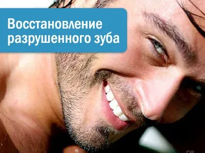 Криві зуби - потрібно художня реставрація (реставрація кривих зубів) Криві зуби - потрібно художня реставрація