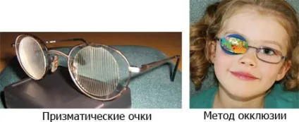 Косоокість (страбізм) причини, види, лікування та профілактика (косоокість) Косоокість (страбізм) причини, види, лікування та профілактика