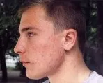 Багато дрібних прищів на лобі чому з'являються (з'являються) Багато дрібних прищів на лобі чому з'являються