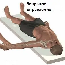 Нестабільність плечового суглоба, центр Дикуля (виконання певних рухів) Нестабільність плечового суглоба, центр Дикуля
