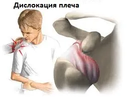 Нестабільність плечового суглоба, центр Дикуля (нестабільності плечового суглоба) Нестабільність плечового суглоба, центр Дикуля