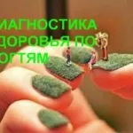 Про що розкажуть ваші нігті (amway в Харкові) Про що розкажуть ваші нігті