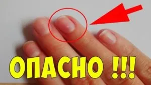 Про що розкажуть ваші нігті (оптимальне здоров'я) Про що розкажуть ваші нігті