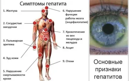 Звідки беруться блохи