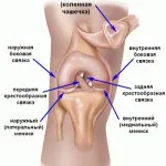 Пластика зв'язок колінного суглоба операція коліна (пластика) Пластика зв'язок колінного суглоба операція коліна