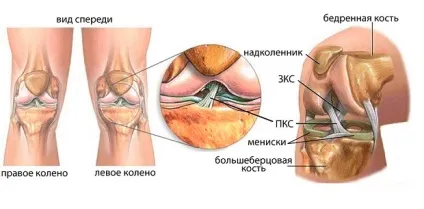 Пластика ПКС колінного суглоба подальше лікування і реабілітація (реабілітація) Пластика ПКС колінного суглоба подальше лікування і реабілітація