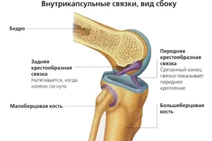 Пластика хрестоподібної зв'язки колінного суглоба (ПКС) (колінного) Пластика хрестоподібної зв'язки колінного суглоба (ПКС)