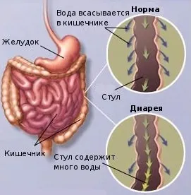 Пронос водою у дорослого - лікування, причини, що робити (пронос) Пронос водою у дорослого - лікування, причини, що робити