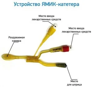 Процедура лікування гаймориту вакуумним методом з синус катетером ЯМІК, відгуки вдячних пацієнтів (катетером) Процедура лікування гаймориту вакуумним методом з синус катетером ЯМІК, відгуки вдячних пацієнтів