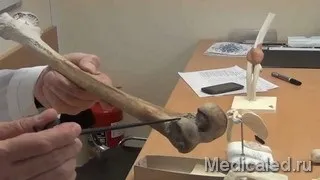 Симптоми захворювання кісток (кісток) Симптоми захворювання кісток